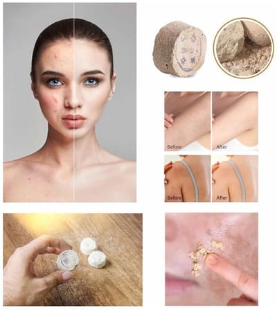 2 Stuks Zeer Effectieve Iraanse Rusur / Rushur Steen Scrub – 100% Natuurlijk – Hammam Peeling Gezicht & Lichaam Verwijderd Dode Huidcellen
