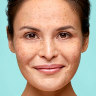 Biodermal Dag & Nachtcrème - 2 x 100 ml - Voordeelverpakking