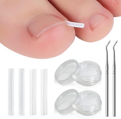 102-delige Set voor het Corrigeren van Ingroeiende Teennagels, Professionele Gereedschappen voor Dikke Nagels en Teennagelcorrectie, Inclusief Nuttige Accessoires voor Thuisgebruik