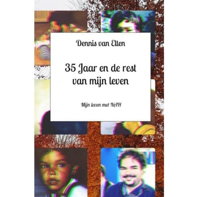 35 Jaar En De Rest Van Mijn Leven - Dennis van Elten