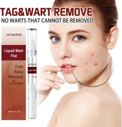 Jaysuing Wratten-Verwijderingspen – Skin Tag & Steelwrat Verwijderen – Moedervlekken & Donkere Vlekken – Natuurlijke huidverzorging – Veilig & Pijnlijkloos Gebruik