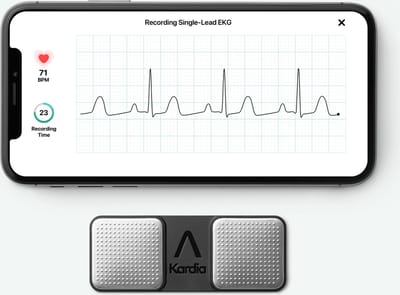 Kardia Mobile 1 kanaals ECG meter - Alivecor