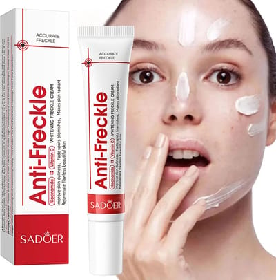 SADOER | Anti-pigment & Anti Sproeten Crème | Whitening Cream | Pigmentvlekken Verwijderen | Hydraterende Gezichtscrème | Anti-Aging | Niacinamide Crème | Donkere & ouderdom Vlekken Verwijderen |Huidverheldering|Hyperpigmentatie |Vitamine B3|Arbutine