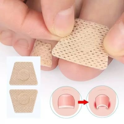 10 Stuks Voetnagel Reparatie Patches tegen Schimmel – Correctie voor Ingegroeide, Dikke & Gele Teennagels – Paronychia, Nagelinfectie & Nagelplaat Herstel