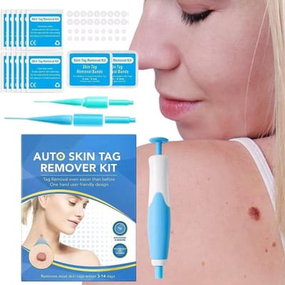 Steelwratjes Verwijderaar Set 2-8mm – Voor het Verwijderen van Steelwratjes en Huidlabeltjes – Geschikt voor Kleine tot Grote Skin Tags – Inclusief Reinigingsdoekjes – Huidverzorging Tool