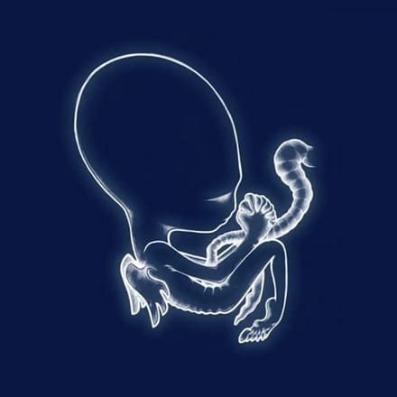 Agaetis Byrjun - Sigur Ros