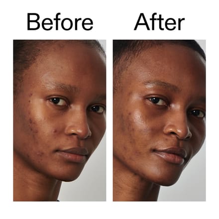 The INKEY List Super Solutions Serum 20% Niacinamide 30 ml