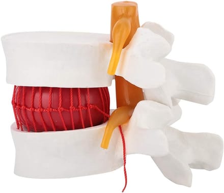 Wervelkolom Model - Anatomisch Model - Medisch Onderwijs - 1.5x Vergroting - 10 x 10 x 10 cm