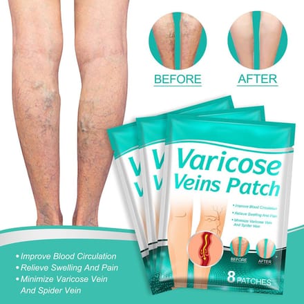 8 stuks spataderpleisters vasculitis flebitis spinaderen stickers voor spataderen spinaderen beige