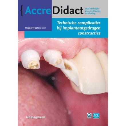 Technische Complicaties Bij Implantaatgedragen Constructies - Accredidact - Gordon van der Avoort