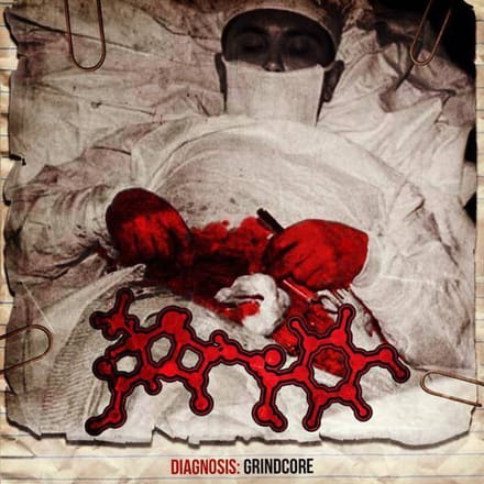 Amoclen: Diagnosis: Grindcore [CD]