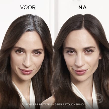 L'Oréal Magic Retouch Uitgroeispray Donkerblond - 3 x 75 ml - Voordeelverpakking