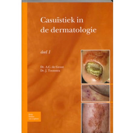 Casuïstiek In De Dermatologie / Deel 1 - A.C. de Groot