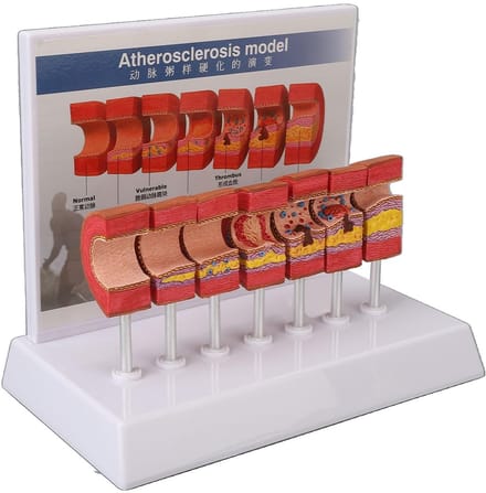 Dailygoods- Slagader Model 7 Stuks - Anatomie Model - Educatief