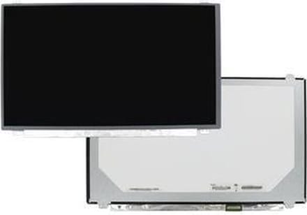 15.6 Inch LCD Scherm 1920x1080 Glans 30Pin eDP