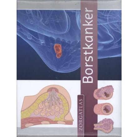 Borstkanker - Zorgatlas - Maria Bruins
