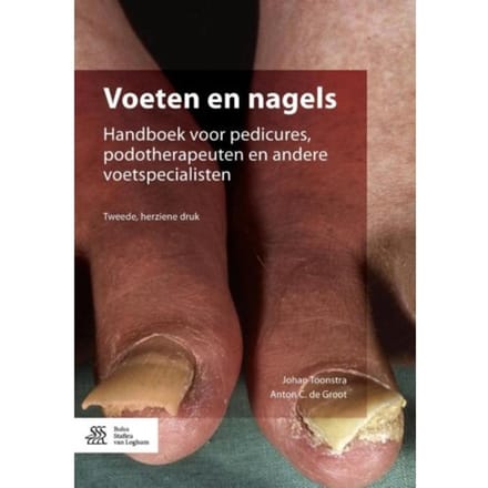 Voeten En Nagels - Johan Toonstra