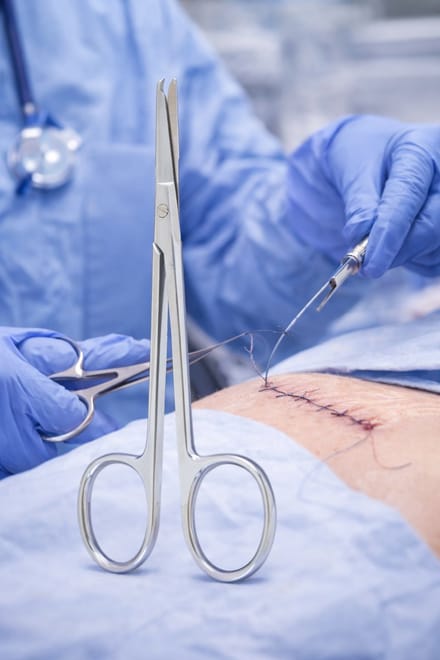 Belux Surgical Instruments – Spencer Onthechtingsschaar 11,5 cm – RVS – Hechtingsschaar – Autoclaveerbaar