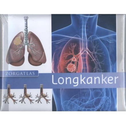 Longkanker - Zorgatlas - Sander de Hosson