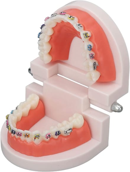 Dental Typodont Teeth Model - Orthodontic Metal Bracket - Dentist Teaching Research - Dental Laboratory
