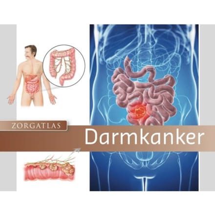 Zorgatlas Darmkanker - Zorgatlas - Riëtte Ruijten-Driessen