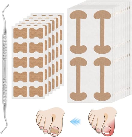 Ingegroeide teennagelbehandeling inclusief 2 soorten teennagelpleisters en professionele ingegroeide teennagelcorrectie