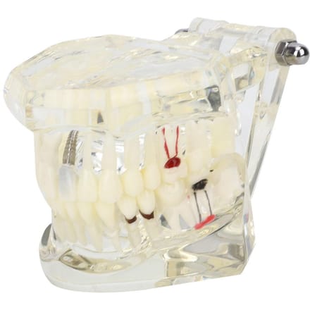 Transparant Ziekte Tanden Model laboratorium Pathologische Anatomie Studie Onderwijs Tand Model white