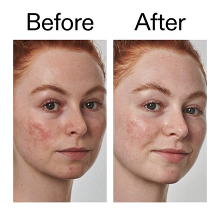 The INKEY List Super Solutions Serum 10% Azelaïnezuur 30 ml