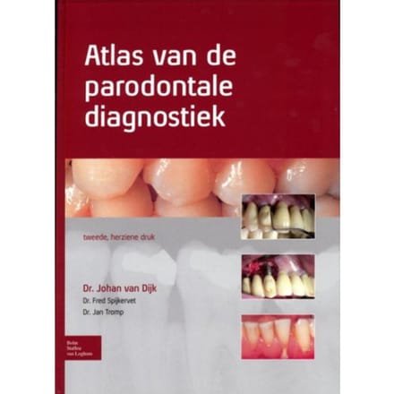 Atlas Van De Parodontale Diagnostiek - Johan van Dijk