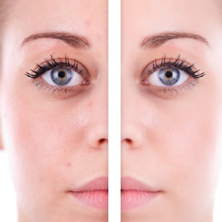 CORRECTOR MINT Kleur: Groen Doel: corrigeert roodheid, couperose, rode vlekjes en rosacea
