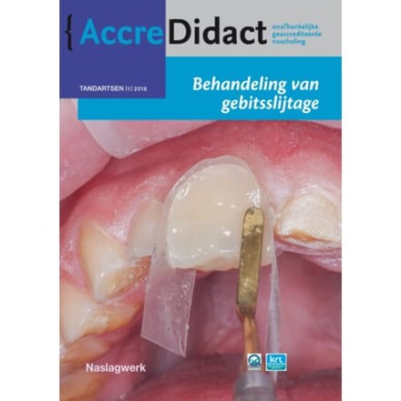 Behandeling Van Gebitsslijtage - Accredidact - Peter Wetselaar