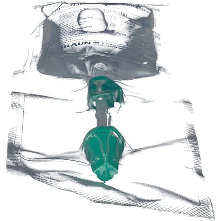 Uro-Tainer NaCl 0,9% 100ml 1 Oplossing