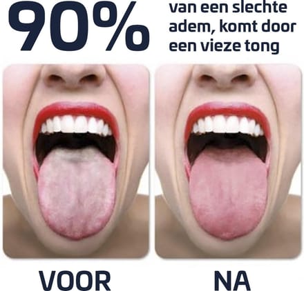 Effectieve Tongschraper - Tongreiniger - Rose Goud
