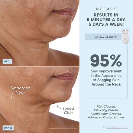 NuFACE TRINITY+® Effective Lip en Eye Attachment