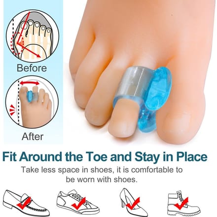 3 Paar Zachte Bunion Spreiders Silicone Gel Teenspreider Duim Corrector Voetverzorgingstool blauw