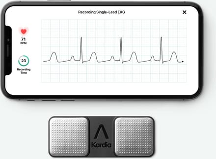 Kardia Mobile 1 kanaals ECG meter - Alivecor
