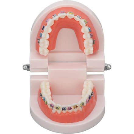 Modèle de dents typodont dentaire avec bracket métallique orthodontique pour enseignement et recherche dentaire white