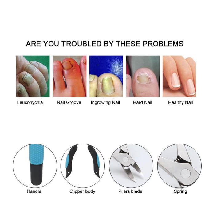 Coupe-ongles incarnés Ciseaux à cuticules pour ongles de doigts et d'orteils Outil de coupe pédicure black