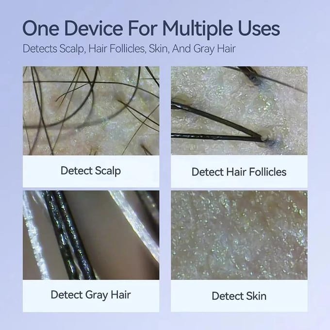 Electronische Dermatoscoop Hoofdhuid Camera Detectie Professionele Gezichtshuid Analyzer Machine Digitale Microscoop Poriën Vergrootglas NIEUW white