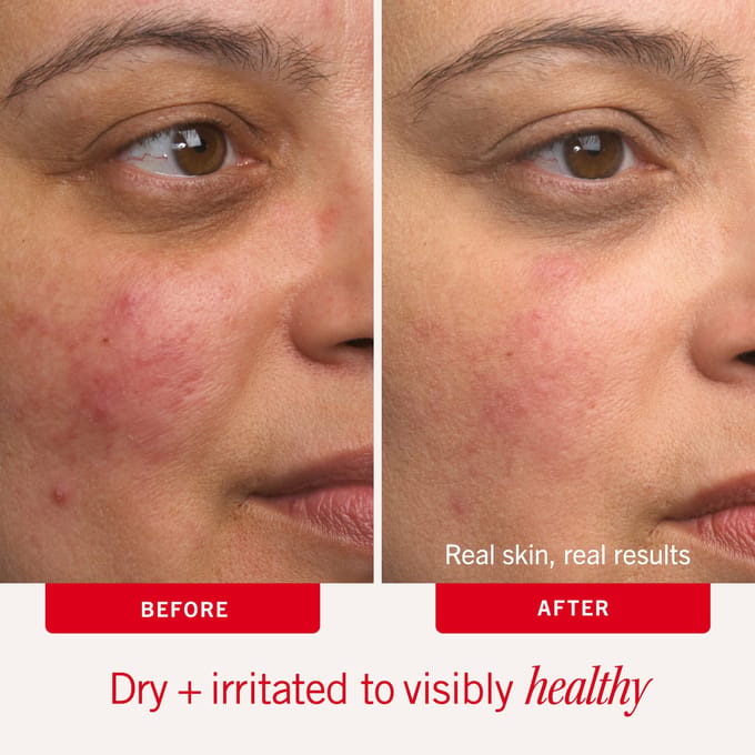 First Aid Beauty Ultra Repair Cream 170g