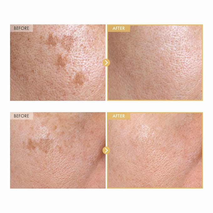 [TOSOWOONG] Black Snail Ginseng Serum 30ml beige