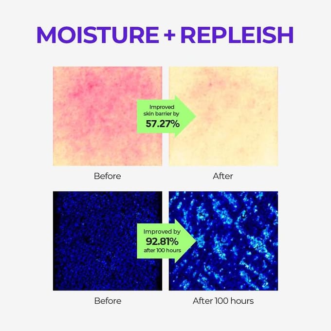 [SKIN&LAB] Barrièrerm Ringer Ampul 70ml white
