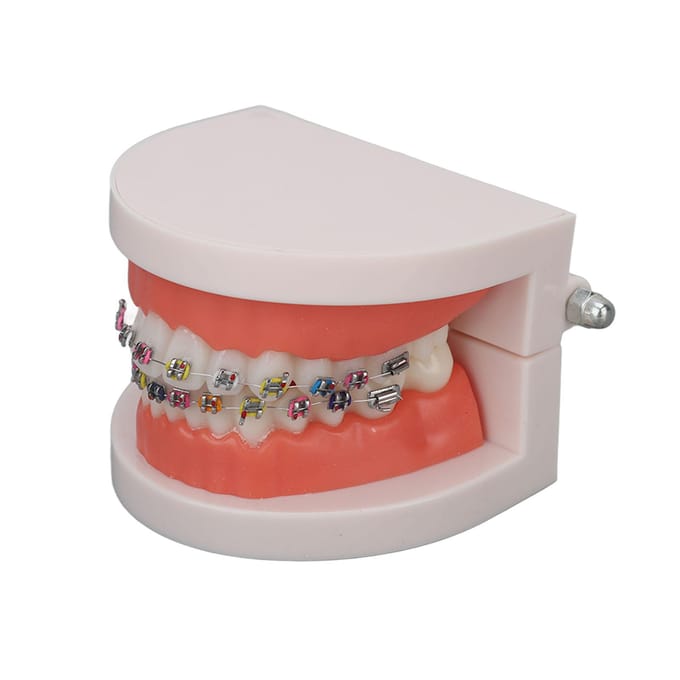 Modèle de dents typodont dentaire avec bracket métallique orthodontique pour enseignement et recherche dentaire white