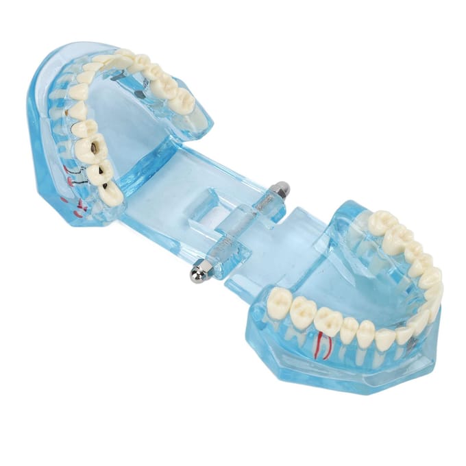 Modèle Pathologique Dentaire Clair Enseignement Détachable Modèle d'Affichage des Dents Dentaires Bleu Transparent white