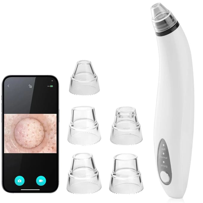 Aspirateur voor mee-eters met ingebouwde camera Paloma Beauties