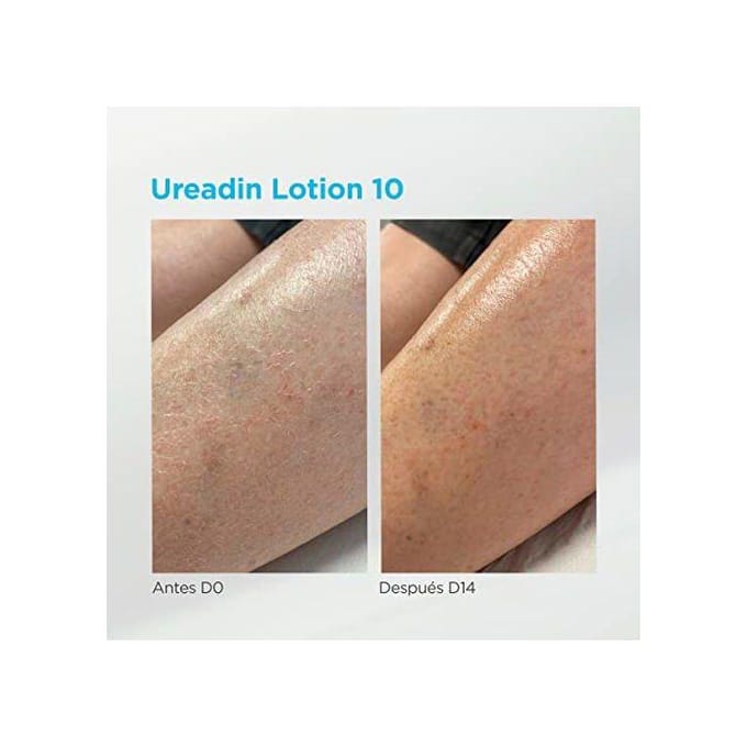Massage Lotion - ISDIN - UREADIN - Hydraterend - Geurloos - Vette Huid