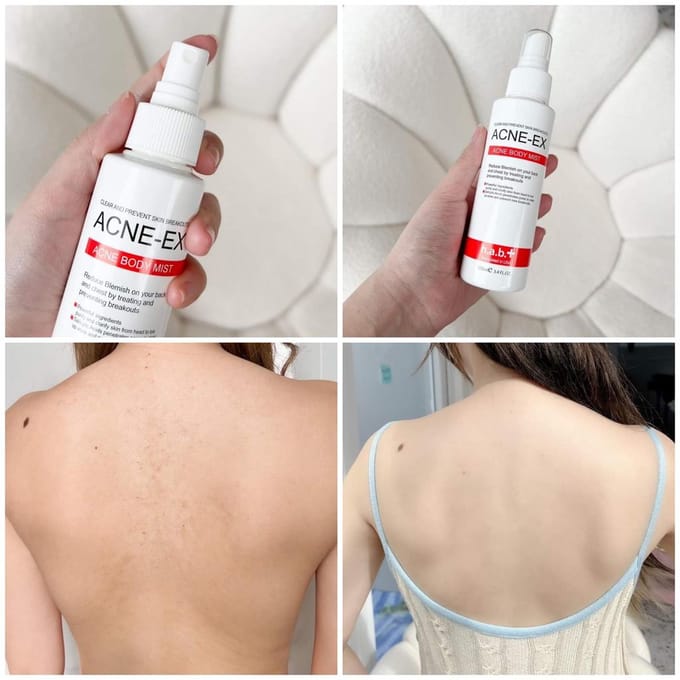ACNE-EX - Lichaamsspray 120 ml. 120 ml. white