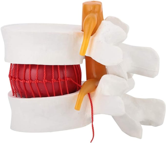 Wervelkolom Model - Anatomisch Model - Medisch Onderwijs - 1.5x Vergroting - 10 x 10 x 10 cm