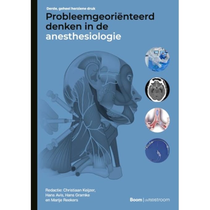 Probleemgeoriënteerd Denken In De Anesthesiologie - Christiaan Keijzer