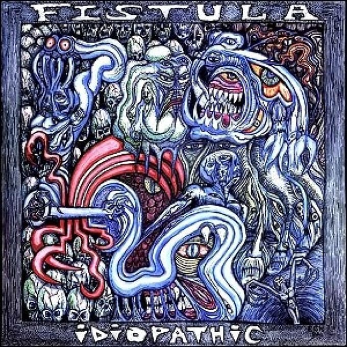 Idiopathic